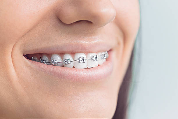Best Invisalign and Clear Aligners  in Five Points, FL